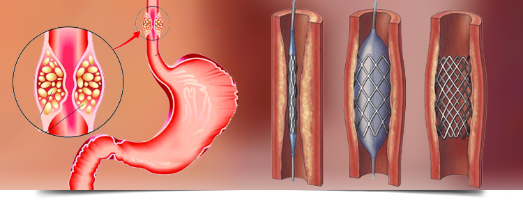 Best Gastroenterologist in Bathinda